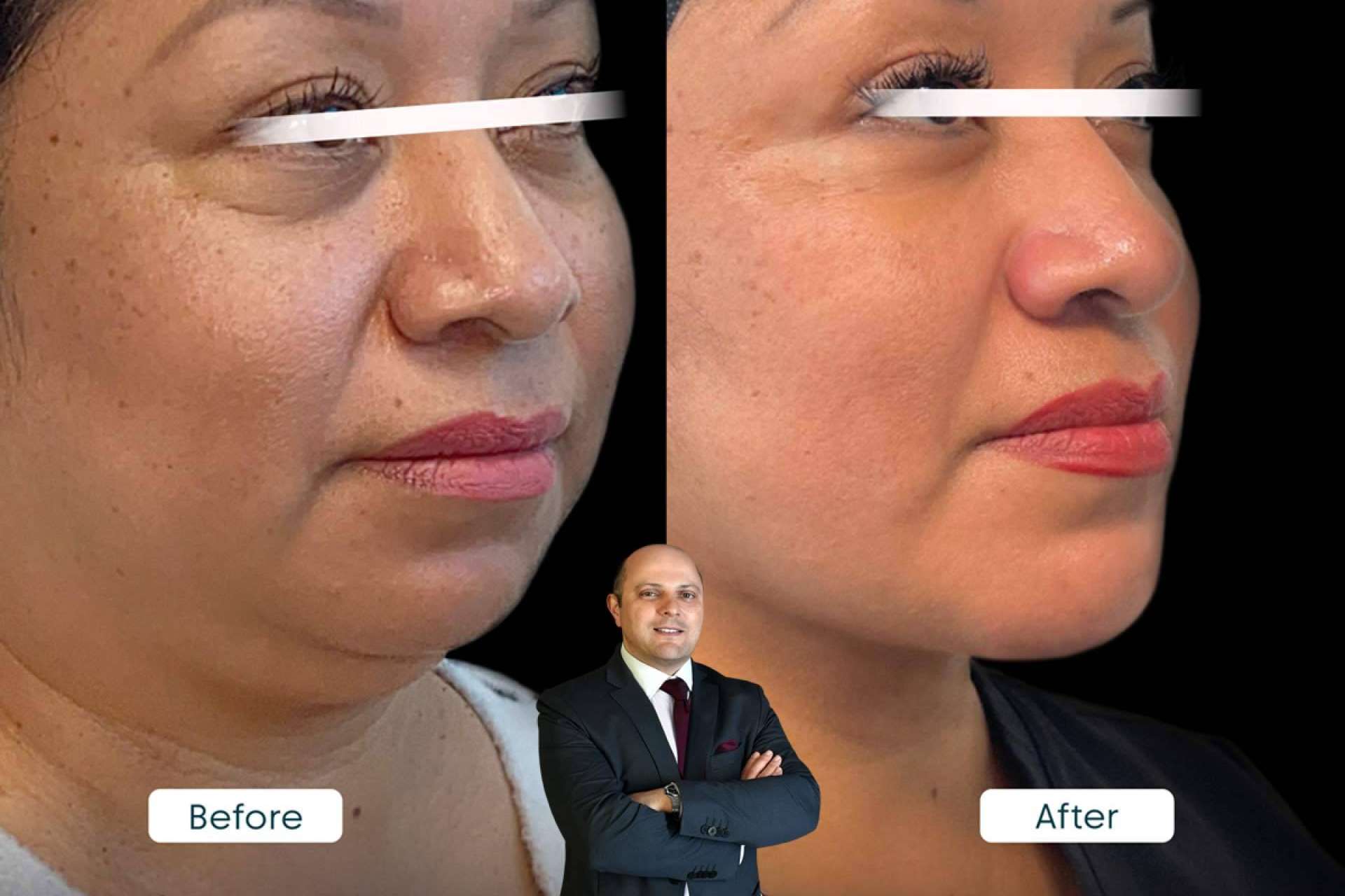 From Hollywood to Miami; Elite Plastic Surgery Is Now Closer Than Ever